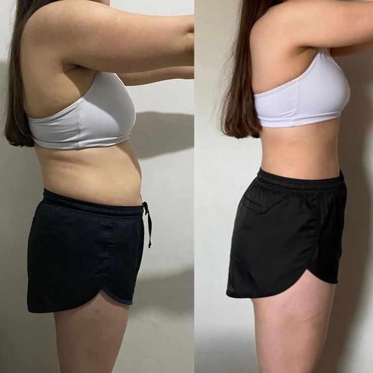 How to deblot naturally before vs after